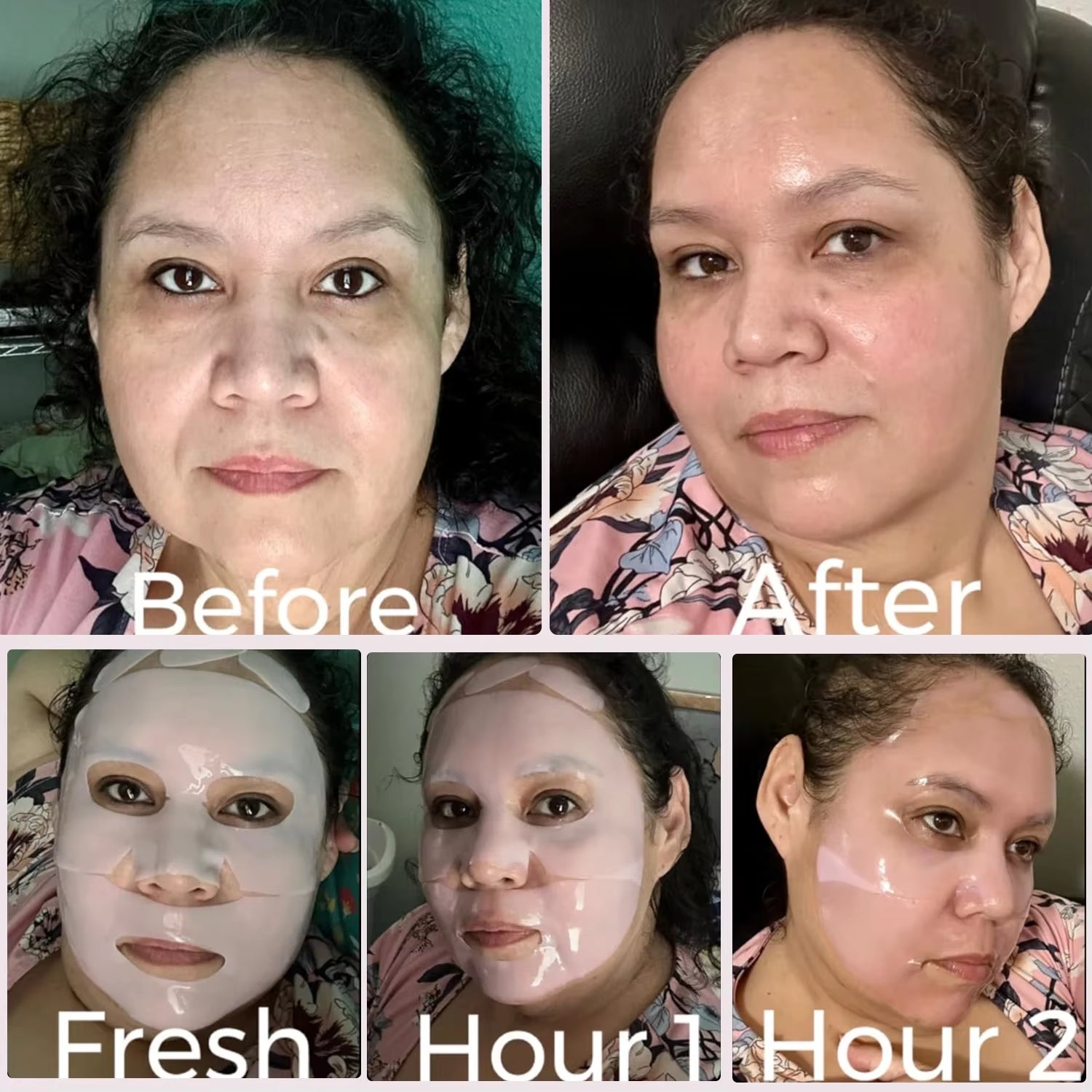 Revitalize Your Skin Overnight with the Collagen-Infused Salmon DNA PDRN Face Mask for a Radiant Glow and Enhanced Elasticity